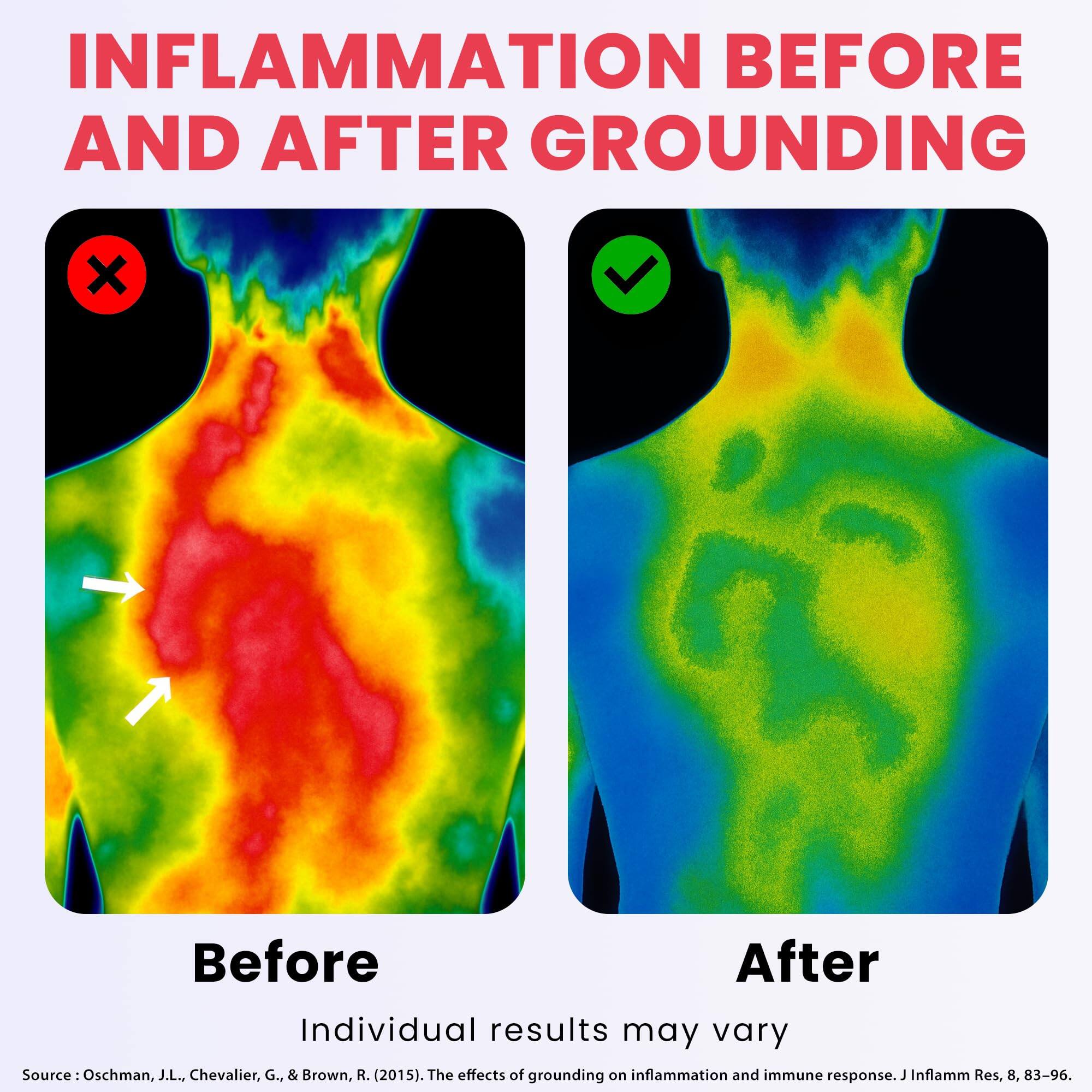 INFLAMMATION BEFORE AND AFTER GROUNDING

Before After

Individual results may vary

Source: Oschman, J.L., Chevalier, G., & Brown, R. (2015). The effects of grounding on inflammation and immune response. J Inflamm Res, 8, 83-96.