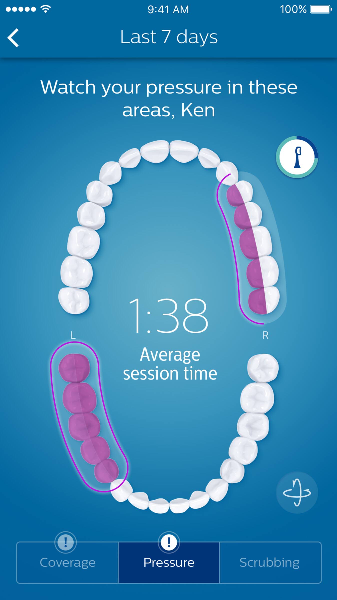 Last 7 days

Watch your pressure in these areas, Ken

1:38 Average session time

Coverage Pressure Scrubbing