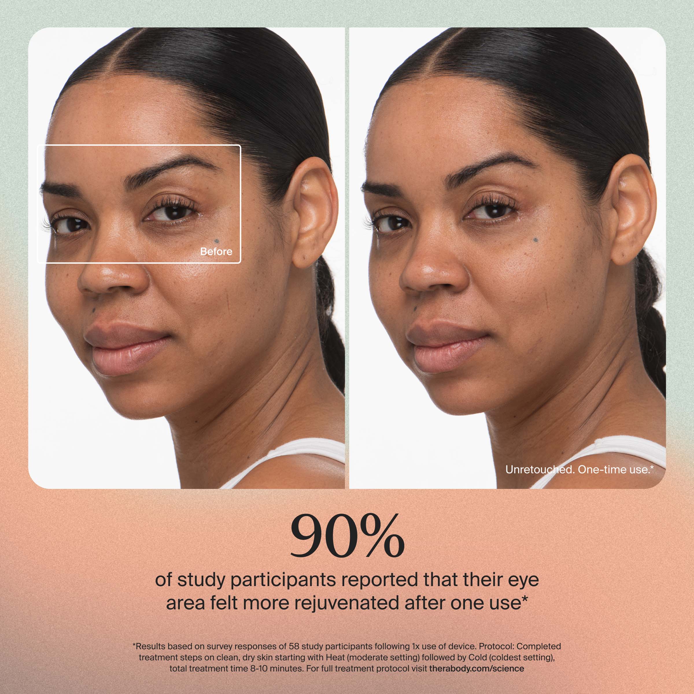 Before  
Unretouched. One-time use.

90% of study participants reported that their eye area felt more rejuvenated after one use*

*Results based on survey responses of 58 study participants following 1x use of device. Protocol: Completed treatment steps on clean, dry skin starting with Heat (moderate setting) followed by Cold (coldest setting). total treatment time 8-10 minutes. For full treatment protocol visit therabody.com/science