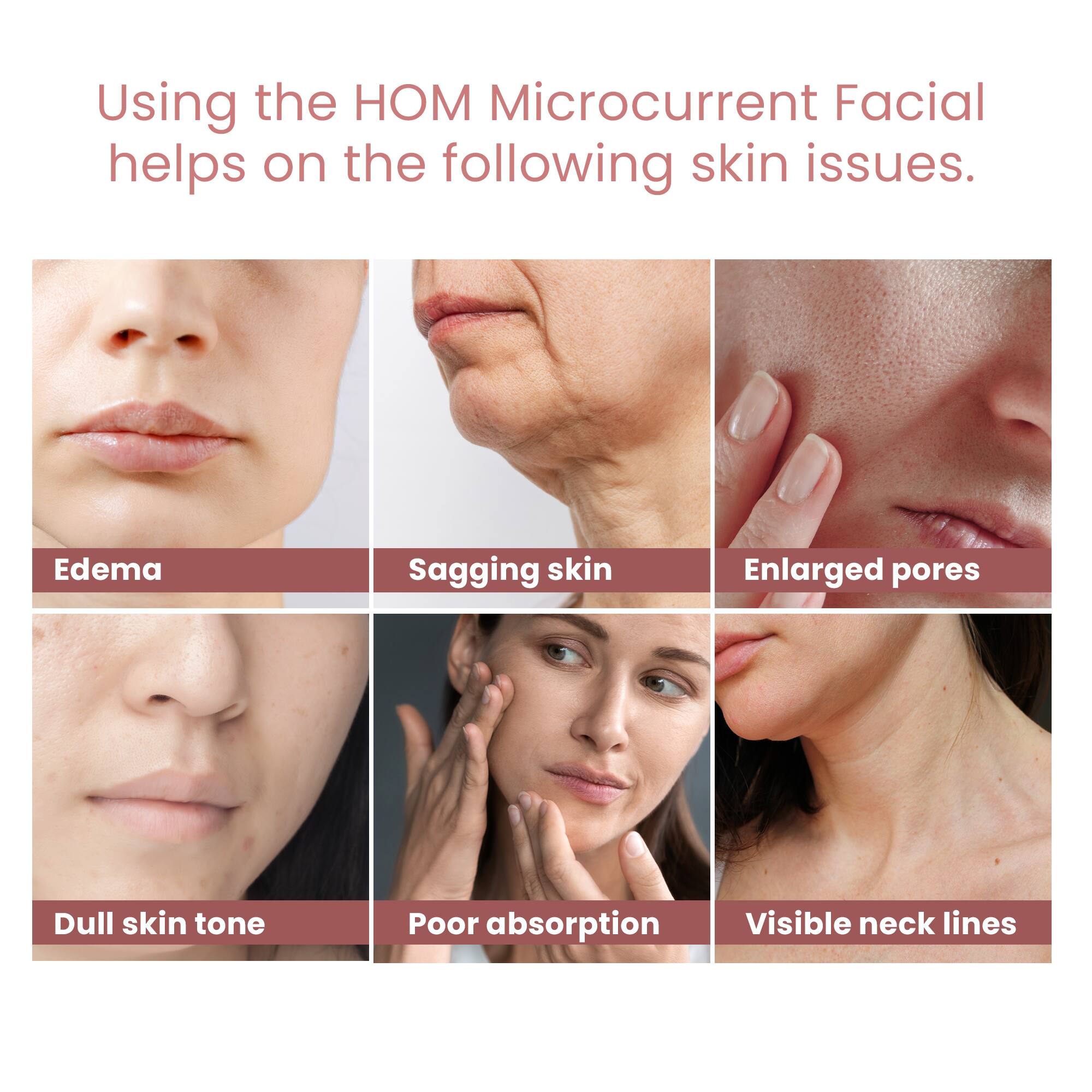 Using the HOM Microcurrent Facial helps on the following skin issues.

- Edema
- Sagging skin
- Enlarged pores
- Dull skin tone
- Poor absorption
- Visible neck lines