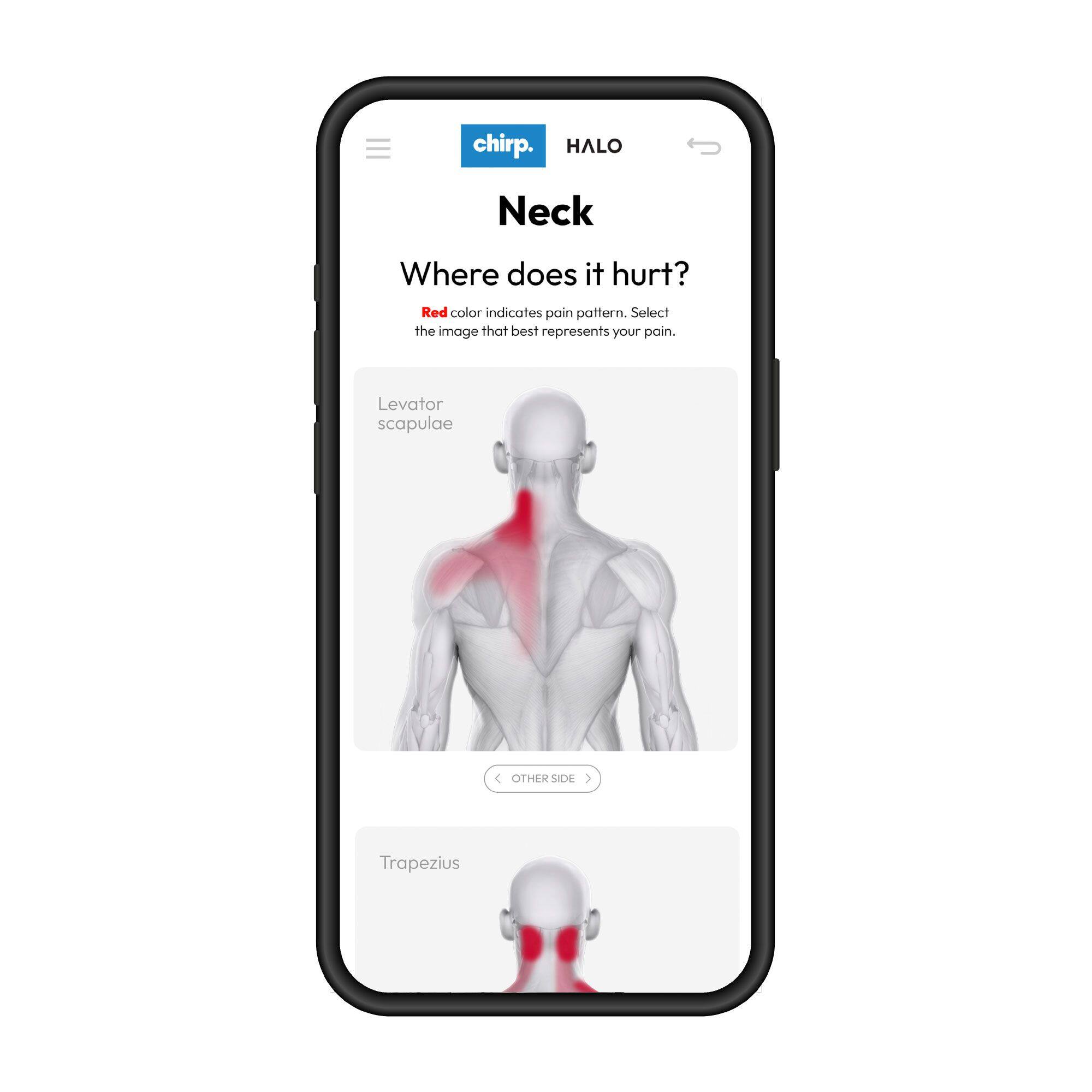 Chirp HALO Neck: Where does it hurt? Red color indicates pain pattern. Select the image that best represents your pain. Levator scapulae, Trapezius, or Other Side.