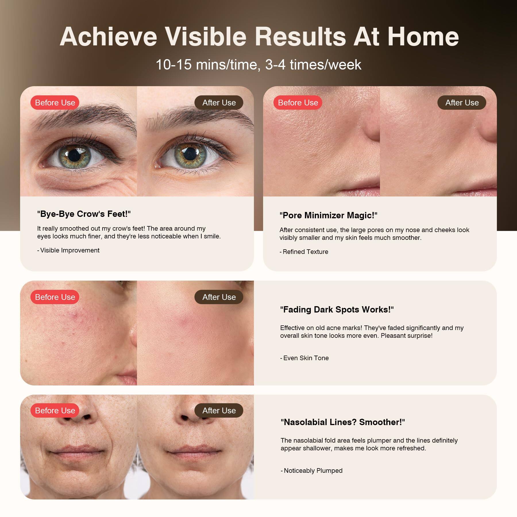 Achieve Visible Results At Home  
10-15 mins/time, 3-4 times/week  

**Before Use** | **After Use**  
"Bye-Bye Crow's Feet!"  
It really smoothed out my crow's feet! The area around my eyes looks much finer, and they're less noticeable when I smile.  
- Visible Improvement  

**Before Use** | **After Use**  
"Pore Minimizer Magic!"  
After consistent use, the large pores on my nose and cheeks look visibly smaller and my skin feels much smoother.  
- Refined Texture  

**Before Use** | **After Use**  
"Fading Dark Spots Works!"  
Effective on old acne marks! They've faded significantly and my overall skin tone looks more even. Pleasant surprise!  
- Even Skin Tone  

**Before Use** | **After Use**  
"Nasolabial Lines? Smoother!"  
The nasolabial fold area feels plumper and the lines definitely appear shallower, makes me look more refreshed.  
- Noticeably Plumped