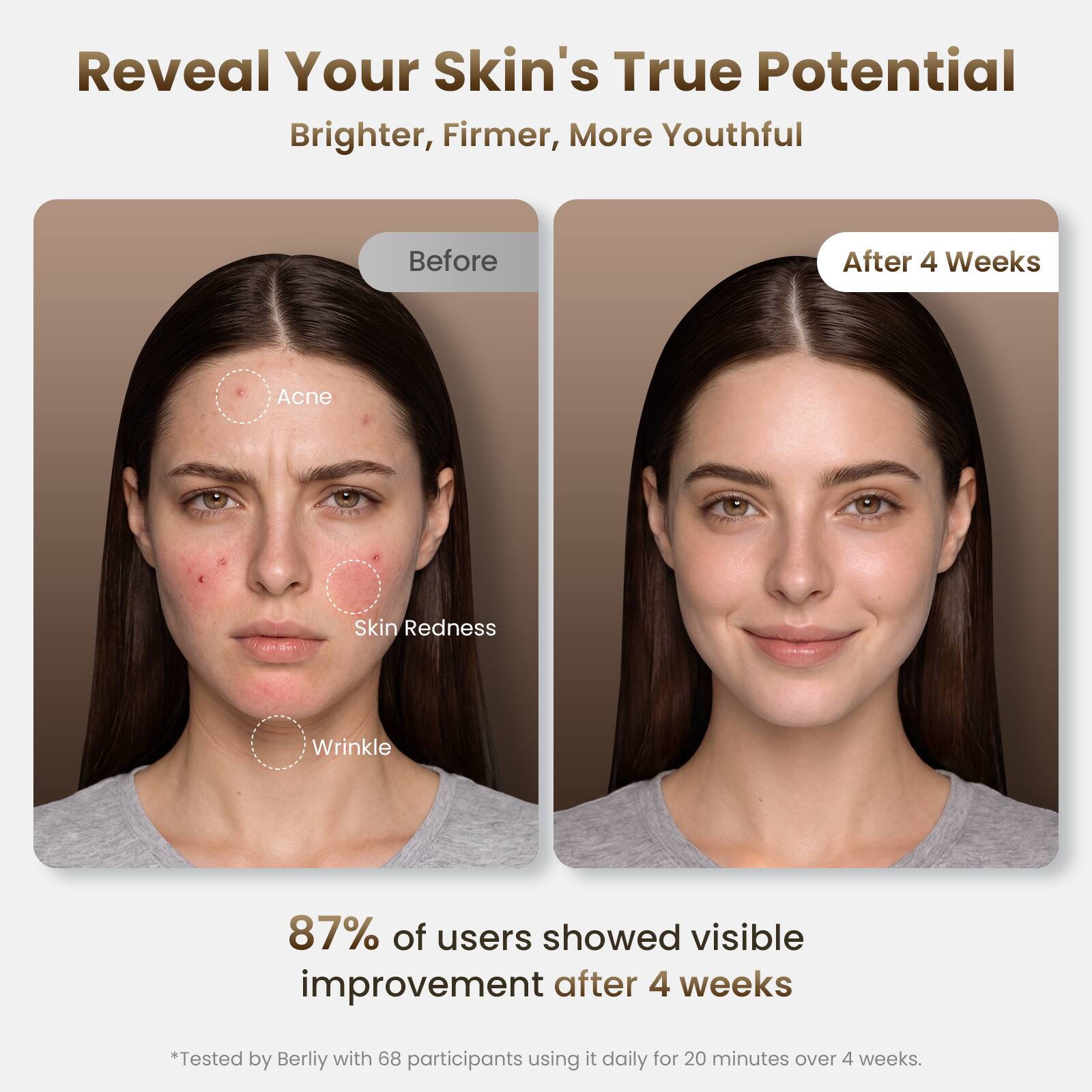 Reveal Your Skin's True Potential  
Brighter, Firmer, More Youthful  

Before  
After 4 Weeks  

Acne  
Skin Redness  
Wrinkle  

87% of users showed visible improvement after 4 weeks  
*Tested by Berliy with 68 participants using it daily for 20 minutes over 4 weeks.