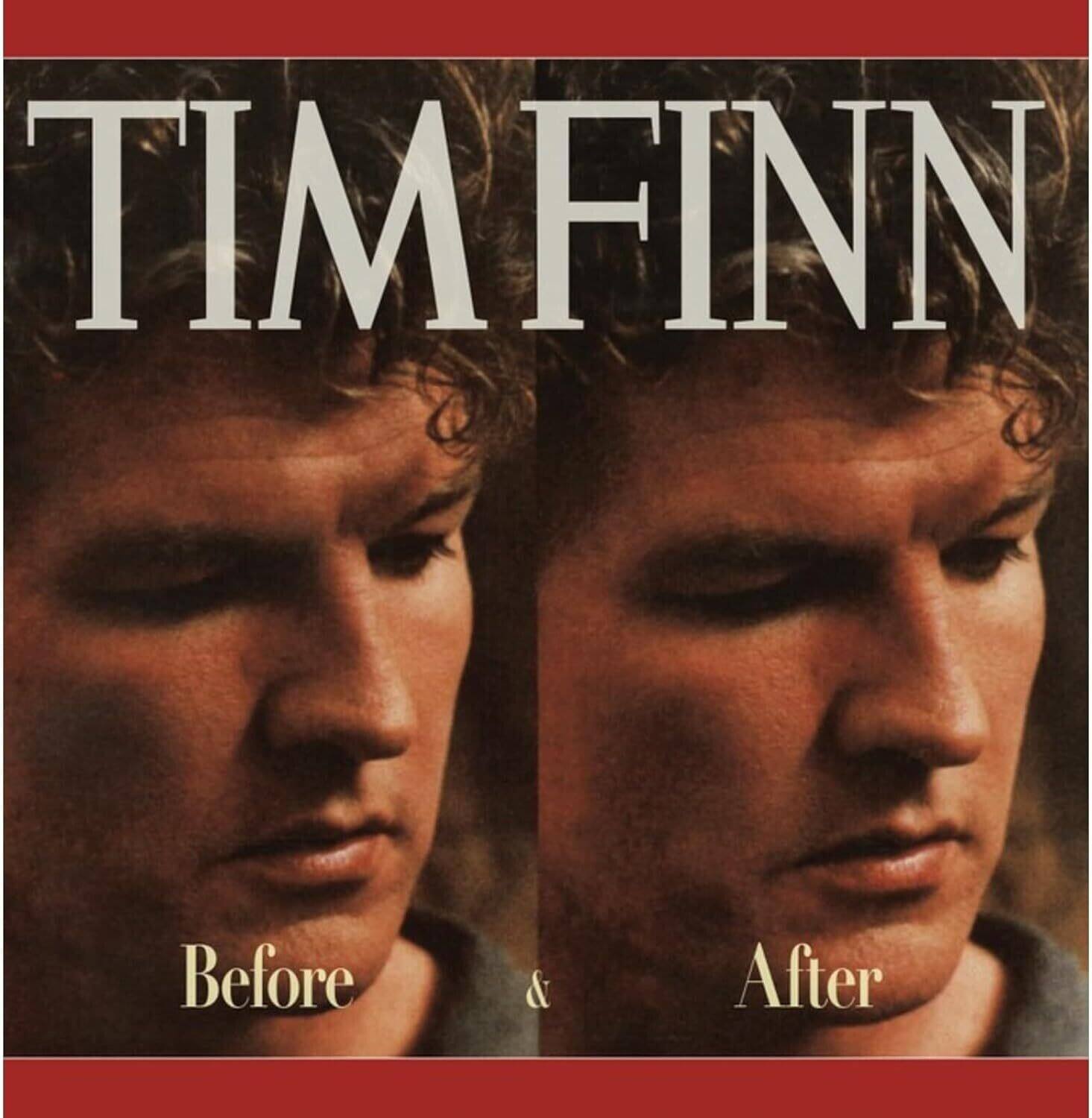 TIM FINN

Before & After