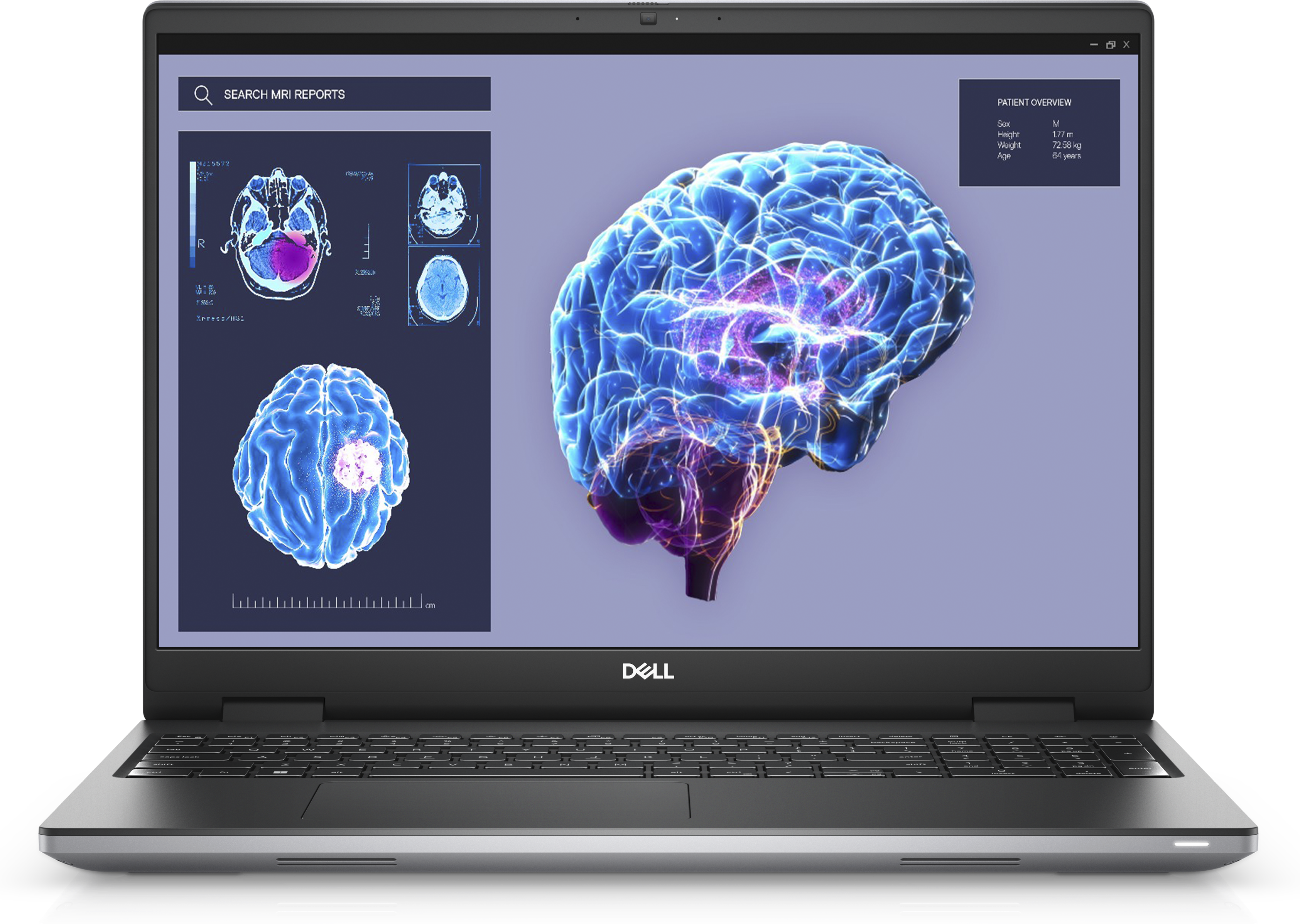 SEARCH MRI REPORTS  
PATIENT OVERVIEW  
Sex: M  
Height: 1.77 m  
Weight: 72.25 kg  
Age: 25 years