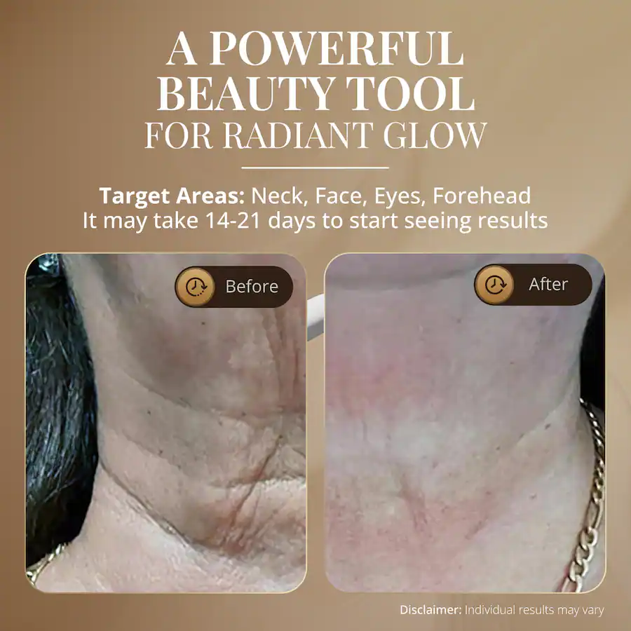 Forehead Target GLO24K Skin Rejuvenation Beauty Device for Face and Neck BD2 - Best Buy