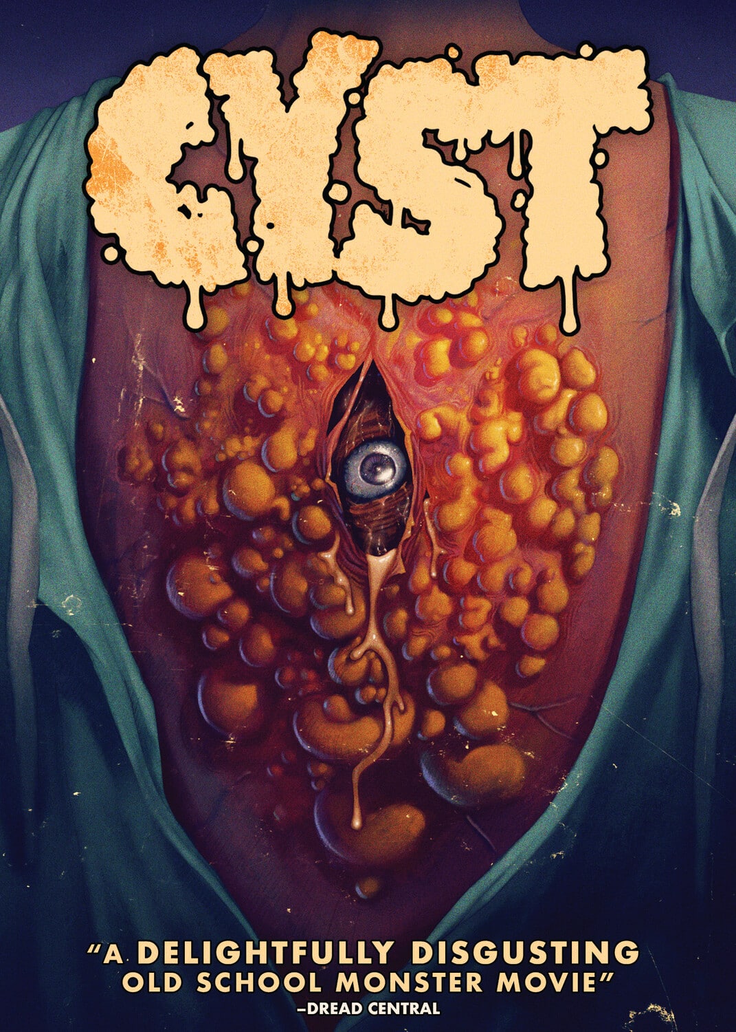 Cyst  - DVD