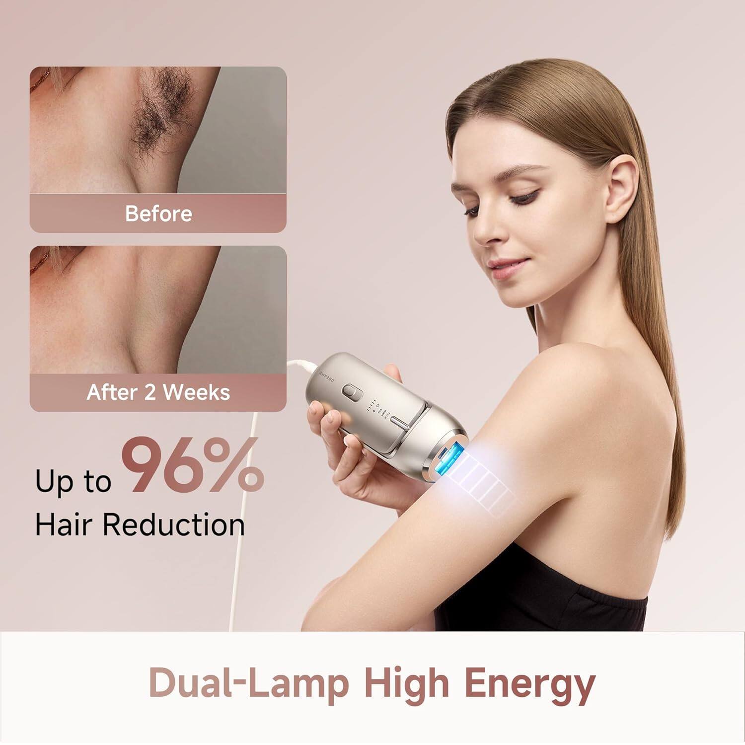 Before  
After 2 Weeks  
Up to 96% Hair Reduction  
Dual-Lamp High Energy