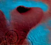 Front. Meddle [Lp] [LP].