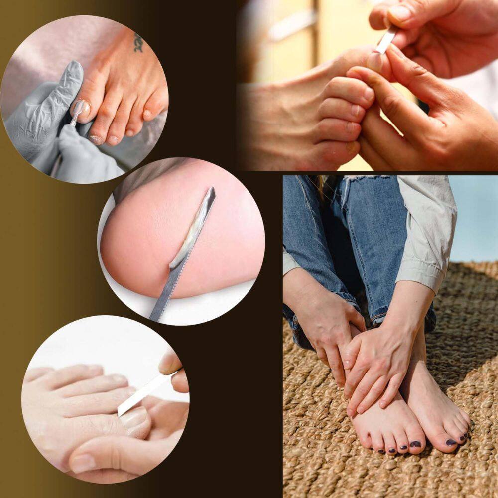 Alt View 3. Beauty Hub Ecommerce - 10-Pack Ingrown Toenail Tool - Silver and Black.