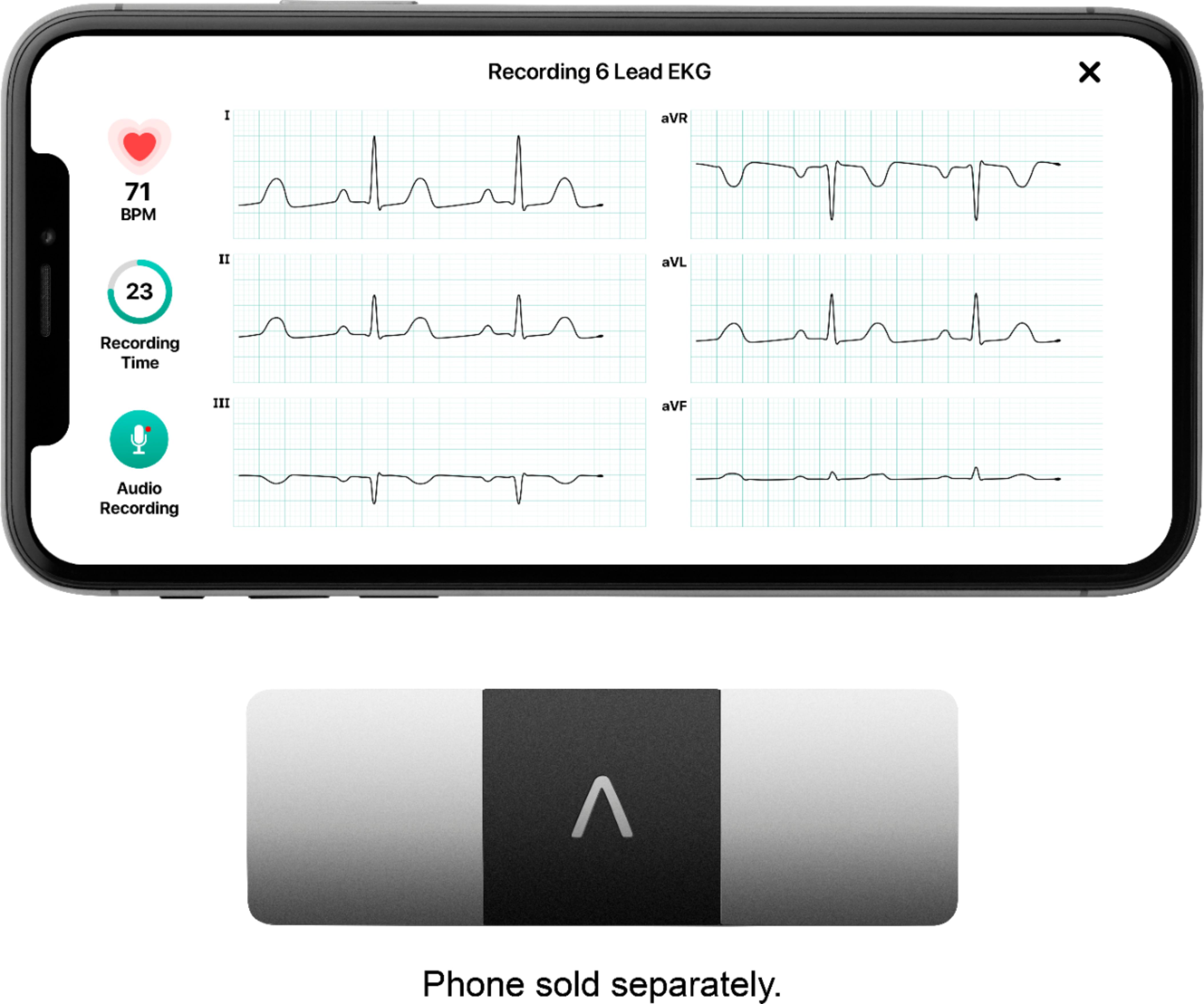  iGuerburn Protective Case for AliveCor KardiaMobile 6-Lead  Personal EKG, Heart Monitor Case for Kardia Mobile 6L ECG (NOT for  KardiaMobile!) : Sports & Outdoors