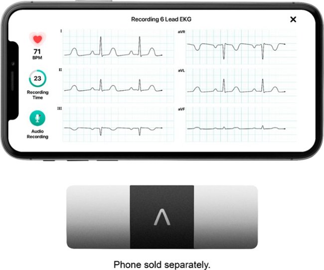 AliveCor - KardiaMobile 6L Personal EKG Monitor - Black_2