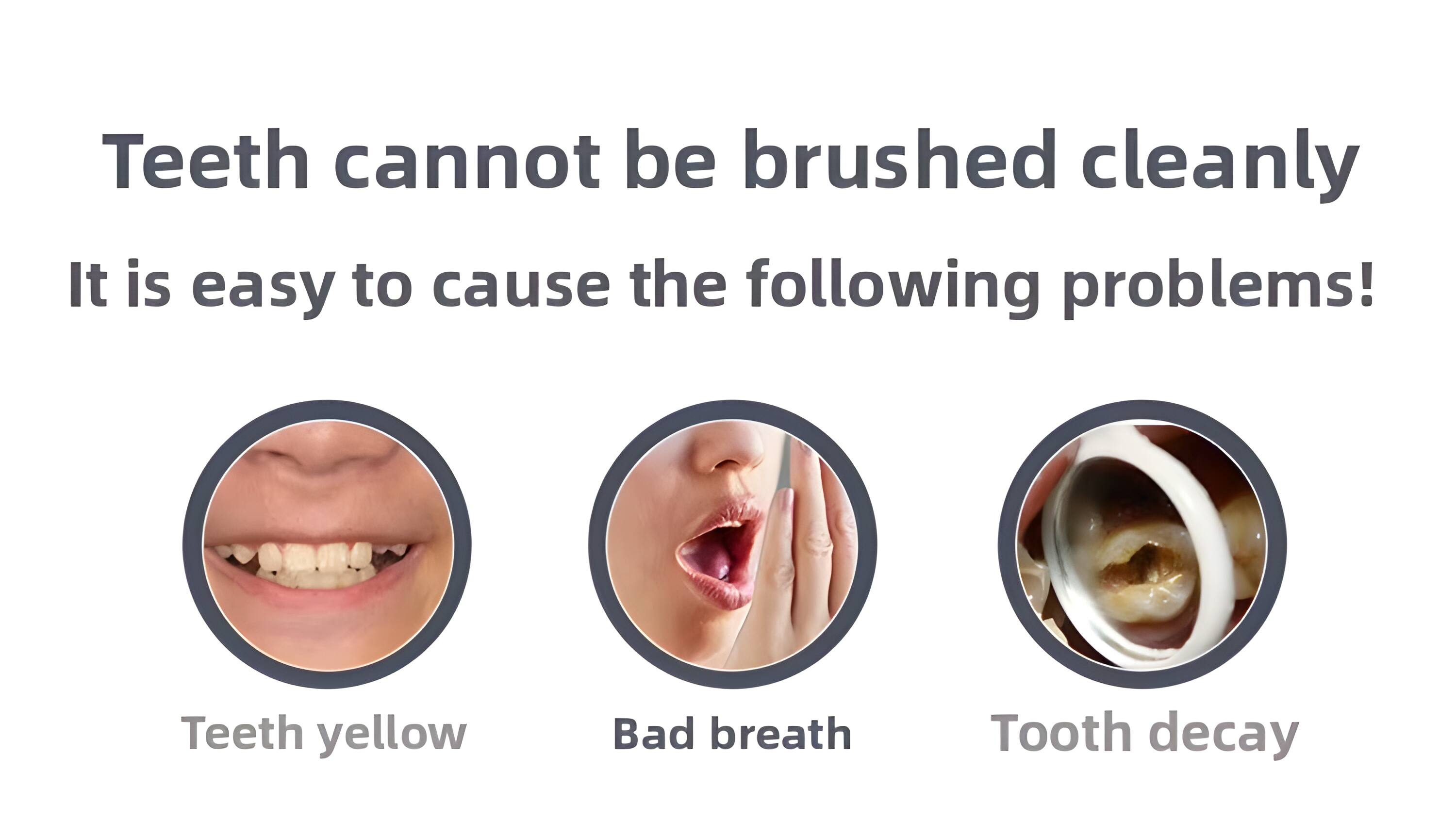 Teeth cannot be brushed cleanly. It is easy to cause the following problems! Teeth yellow, Bad breath, Tooth decay