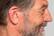 Alt View 17. Eargo - Neo HiFi Hearing Aid - Black.