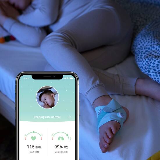 Owlet smart sock deals cost