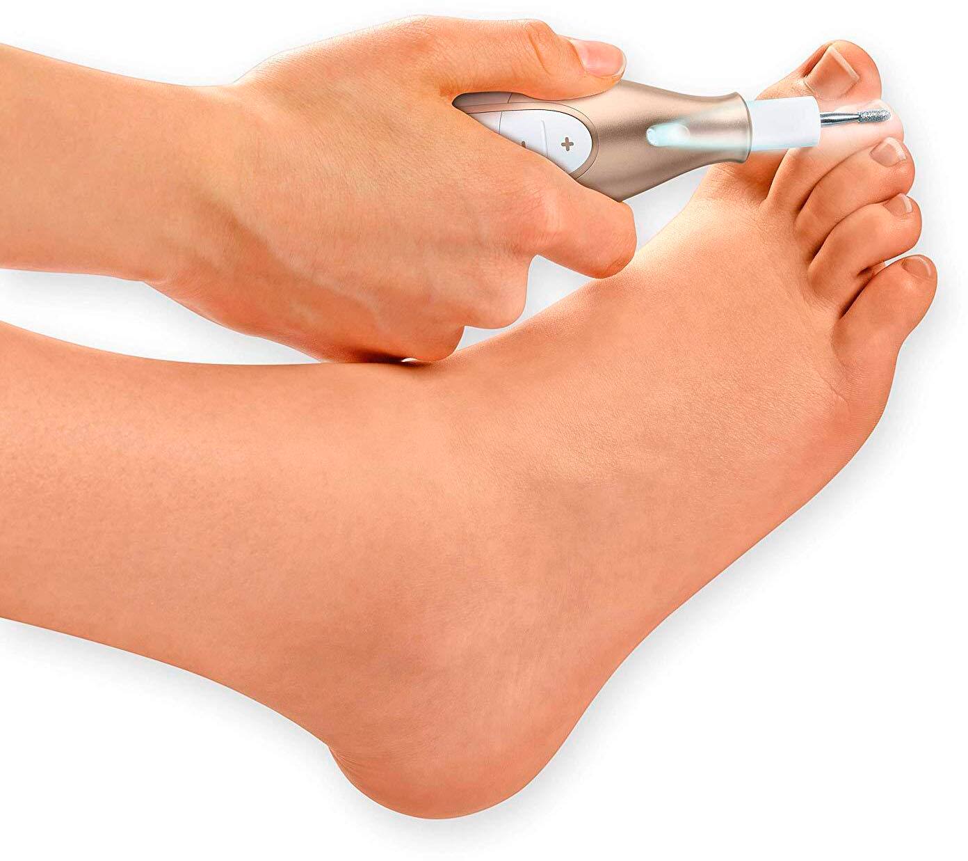 Alt View 12. Beurer - Electric Manicure/Pedicure Set - White & Gold.