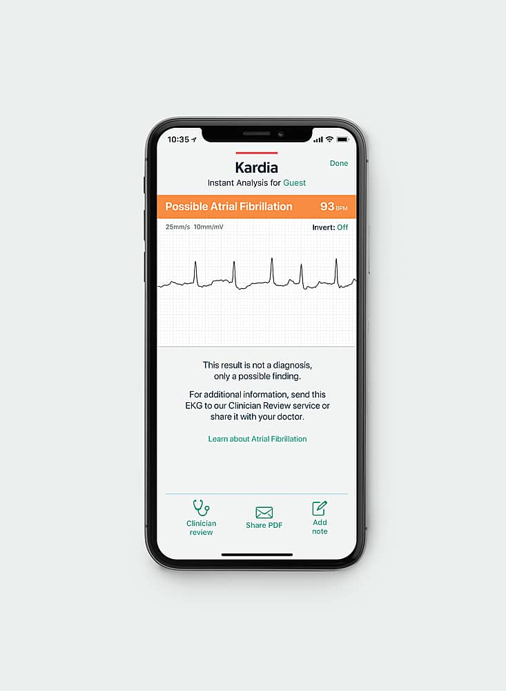 Alt View 11. AliveCor - KardiaCare 1 Year Digital.