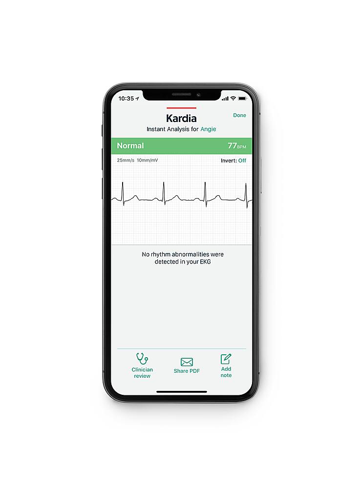 Alt View 13. AliveCor - KardiaCare 1 Year Digital.