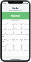 Alt View 15. AliveCor - KardiaCare 90 Days Digital.