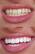 Alt View 13. Snow - Diamond Teeth Whitening Kit - White.