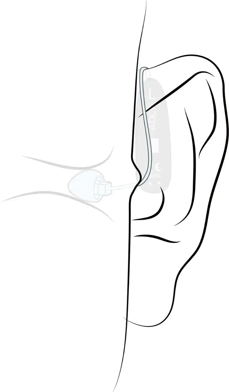 Alt View 39. Sennheiser - All-Day Clear - OTC Self-Fitting Hearing Aid for Mild to Moderate Hearing Loss – All-Day Wear & Bluetooth - Gray.
