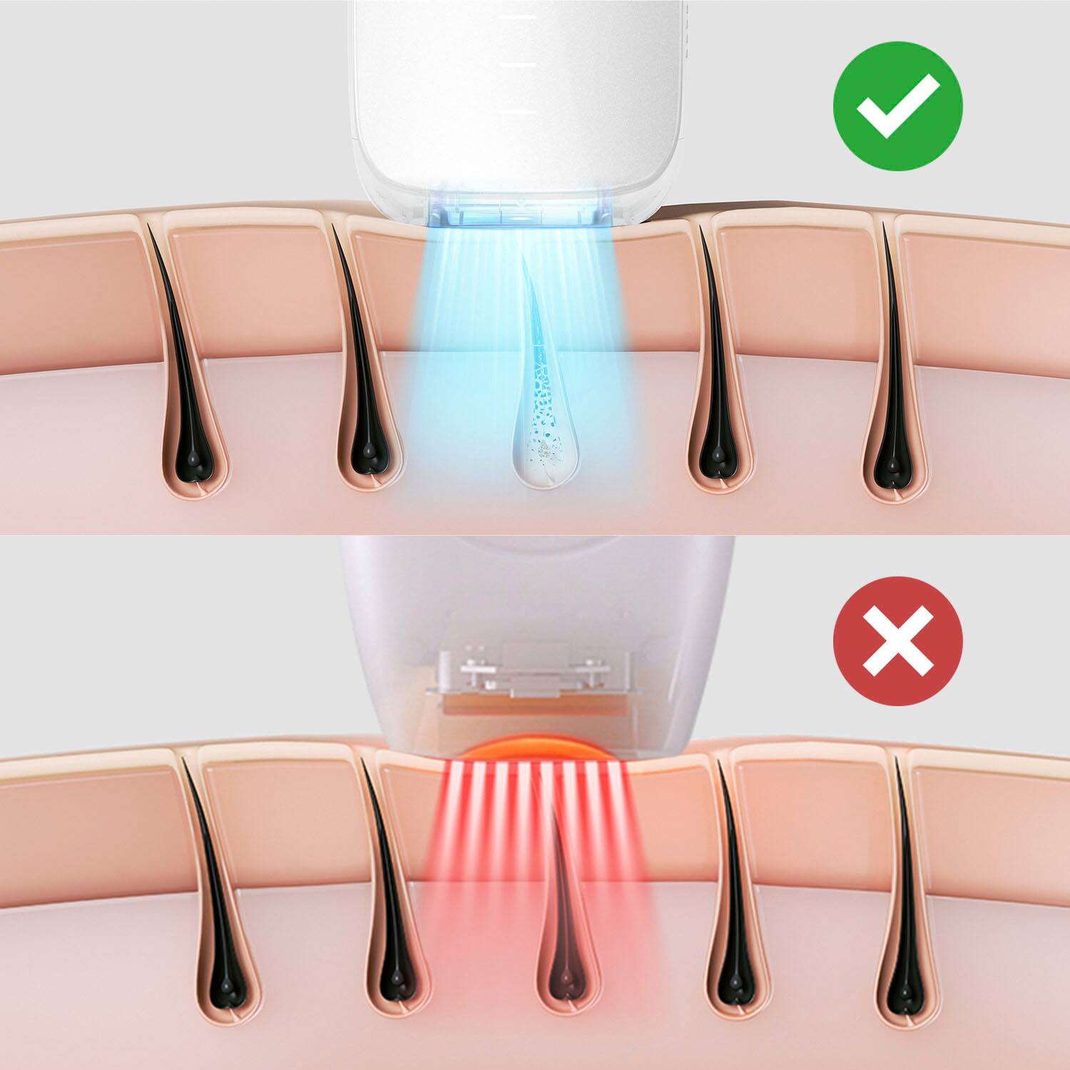 Alt View 11. Ulike - Air 3 Ice Cooling IPL Dry Hair Removal Device - White.