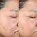 BEFORE AFTER 8 WEEKS Skin Tone & Firmness Enlarged Pores Skin Tone & Firmness Enlarged Pores