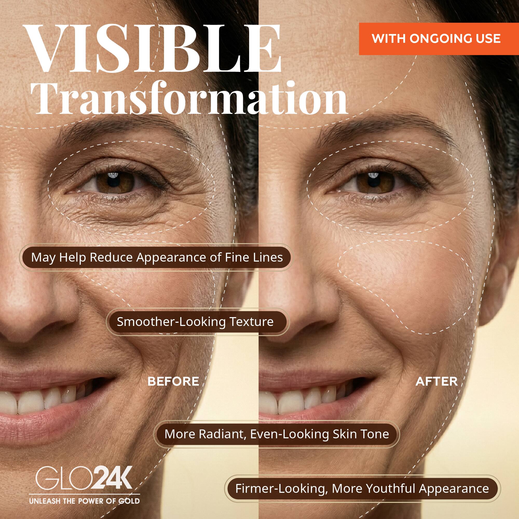 GLO24K 7 Color LED Photon Rejuvenation Super Mask BD9 - Best Buy