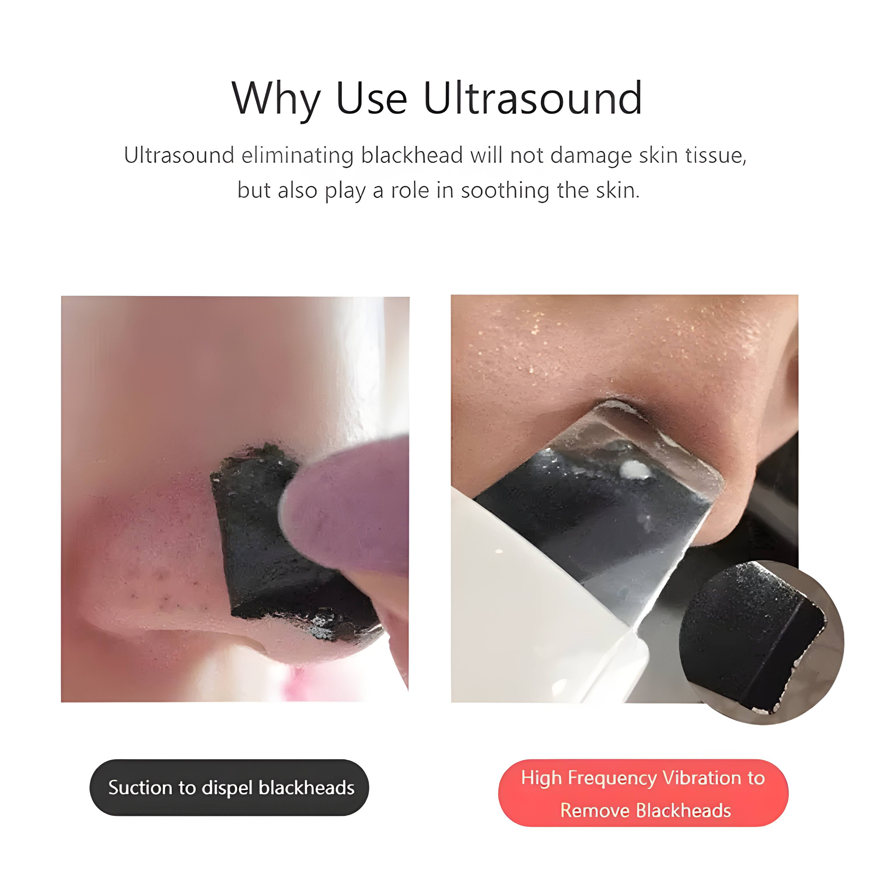 Why Use Ultrasound

Ultrasound eliminating blackhead will not damage skin tissue, but also play a role in soothing the skin.

Suction to dispel blackheads

High Frequency Vibration to Remove Blackheads