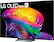 LG OLED evo AI