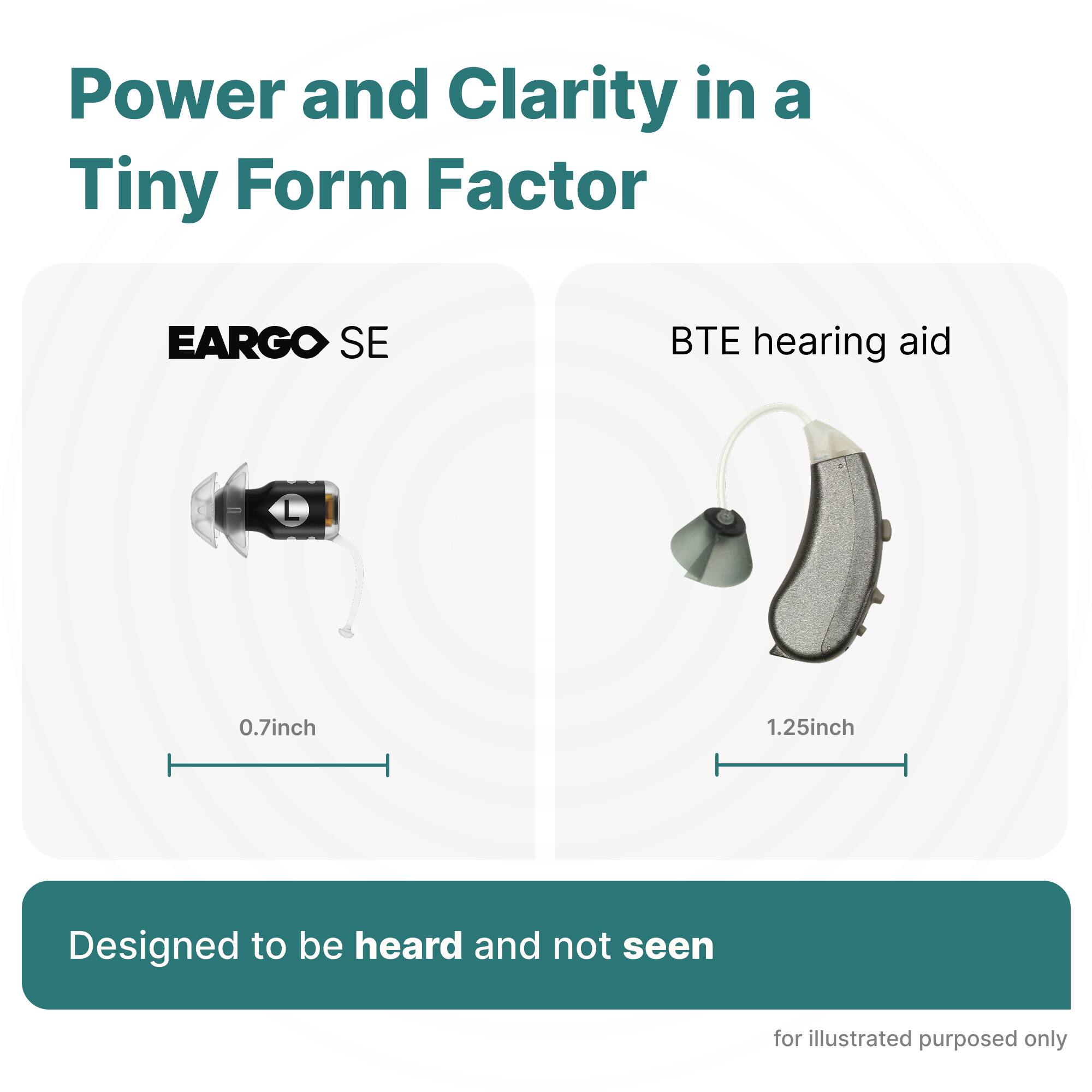 Power and Clarity in a Tiny Form Factor

EARGO SE  
0.7 inch

BTE hearing aid  
1.25 inch

Designed to be heard and not seen

for illustrated purposes only