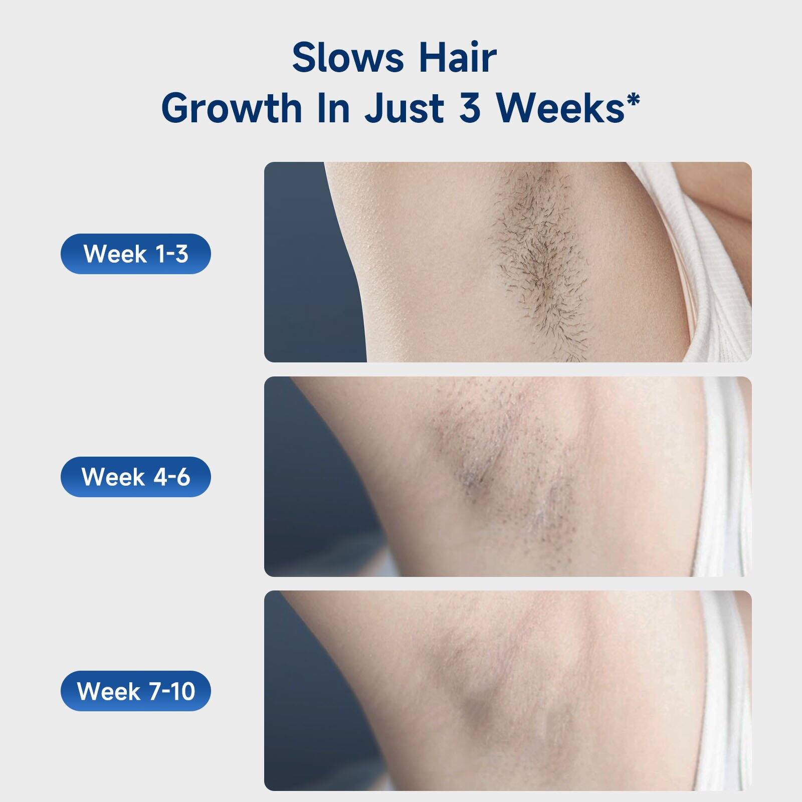 Slows Hair Growth In Just 3 Weeks*

Week 1-3

Week 4-6

Week 7-10