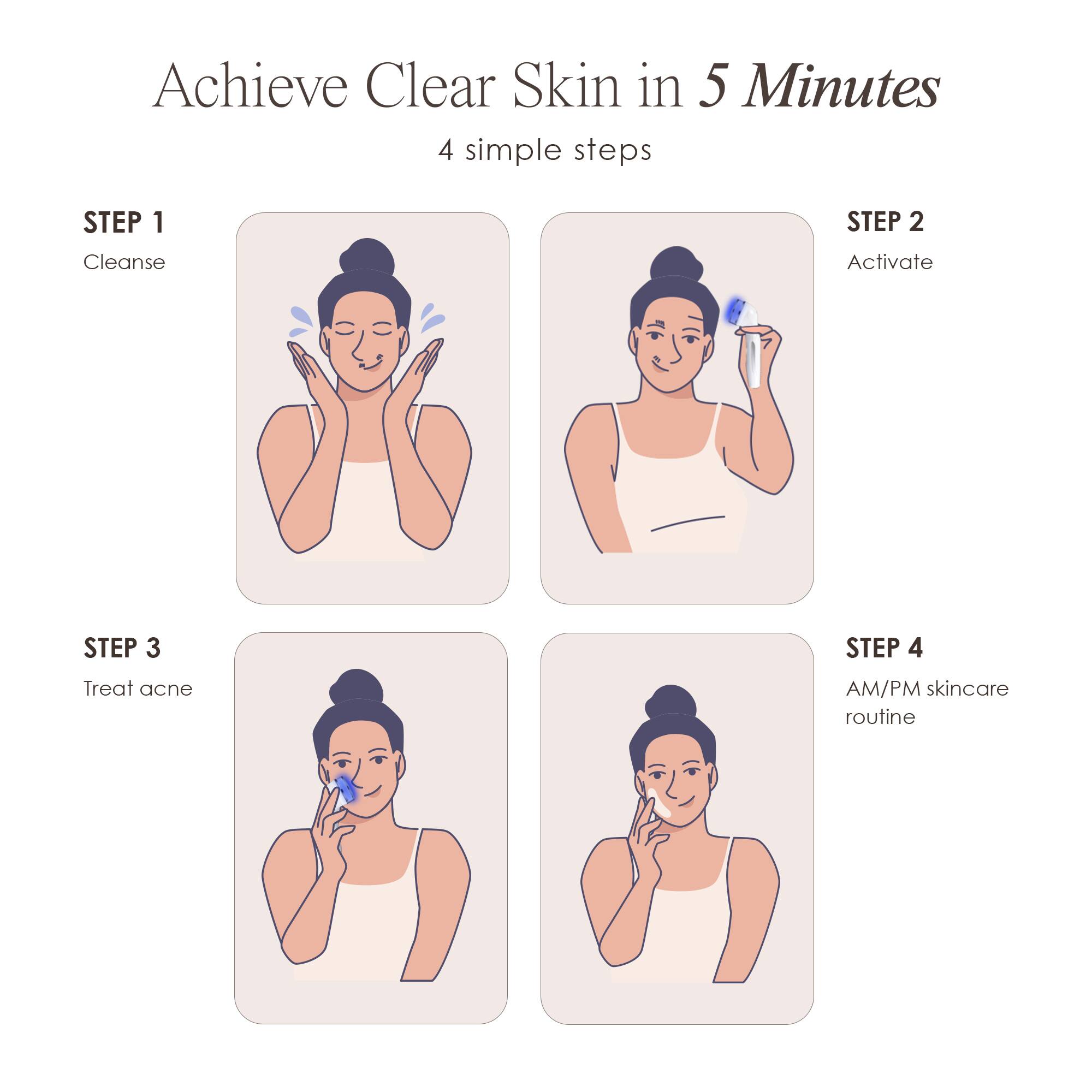 Achieve Clear Skin in 5 Minutes  
4 simple steps

STEP 1  
Cleanse

STEP 2  
Activate

STEP 3  
Treat acne

STEP 4  
AM/PM skincare routine