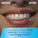 The text on the image is grouped as follows:
BEFORE AFTER Clinically proven up to 2X as effective as string floss for improving gum health* *data on file. simulated