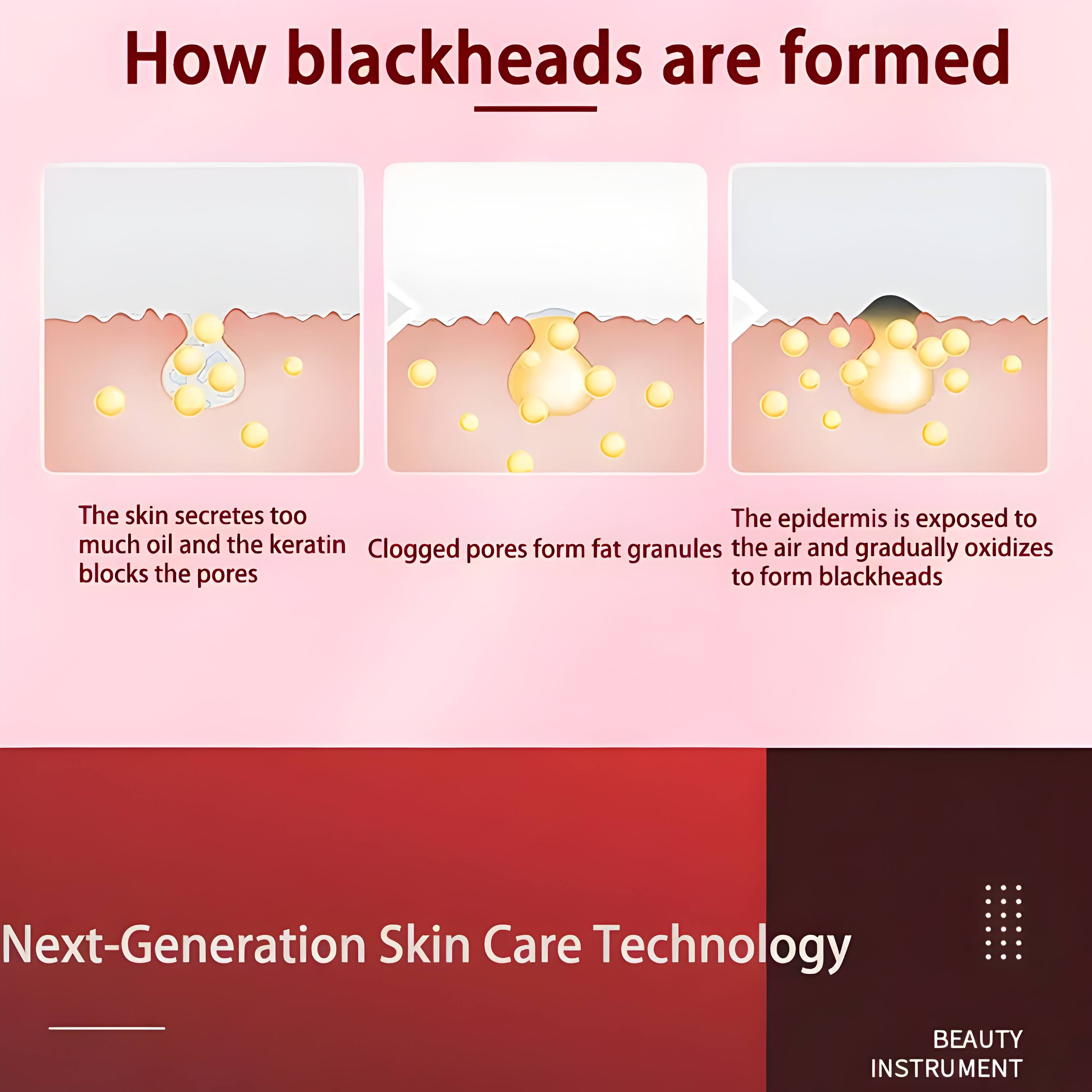 How blackheads are formed

The skin secretes too much oil and the keratin blocks the pores

Clogged pores form fat granules

The epidermis is exposed to the air and gradually oxidizes to form blackheads

Next-Generation Skin Care Technology

BEAUTY INSTRUMENT