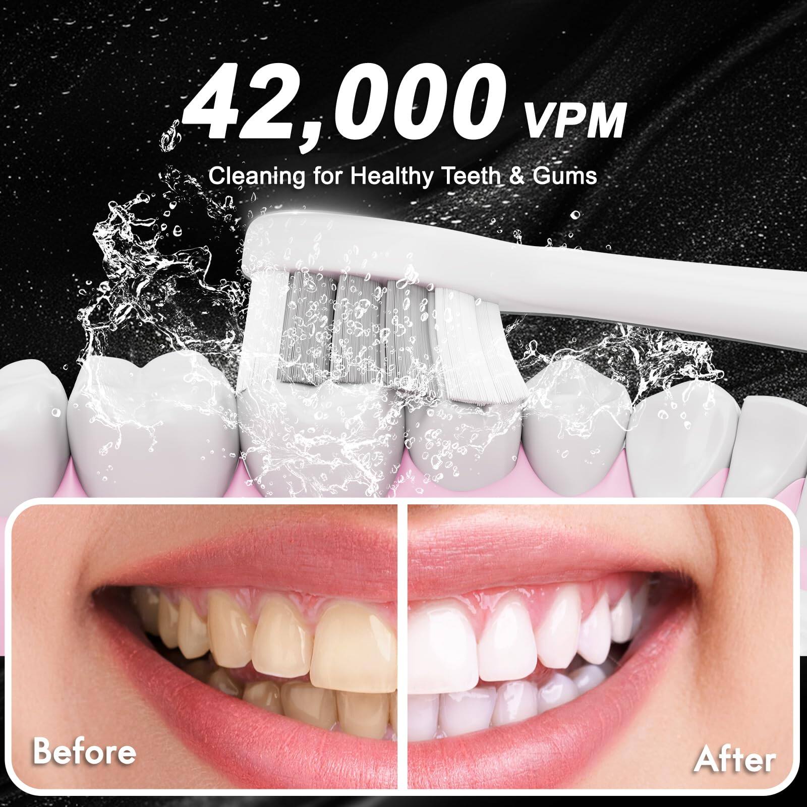42,000 VPM  
Cleaning for Healthy Teeth & Gums  

Before  
After