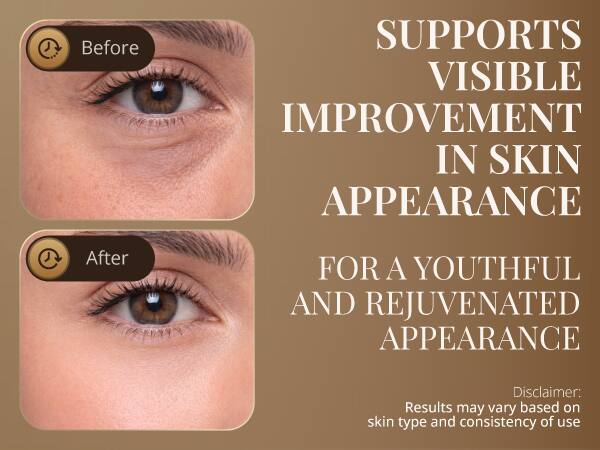 Before: SUPPORTS VISIBLE IMPROVEMENT IN SKIN APPEARANCE  
After: FOR A YOUTHFUL AND REJUVENATED APPEARANCE  

Disclaimer: Results may vary based on skin type and consistency of use