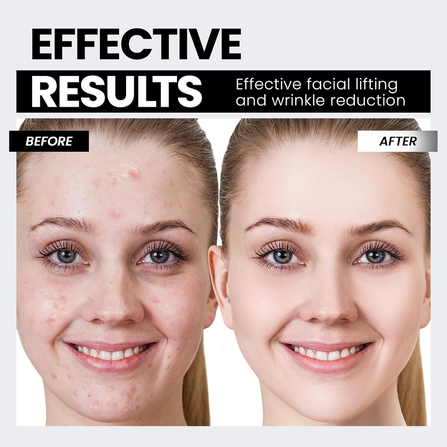 EFFECTIVE RESULTS

Effective facial lifting and wrinkle reduction

BEFORE AFTER