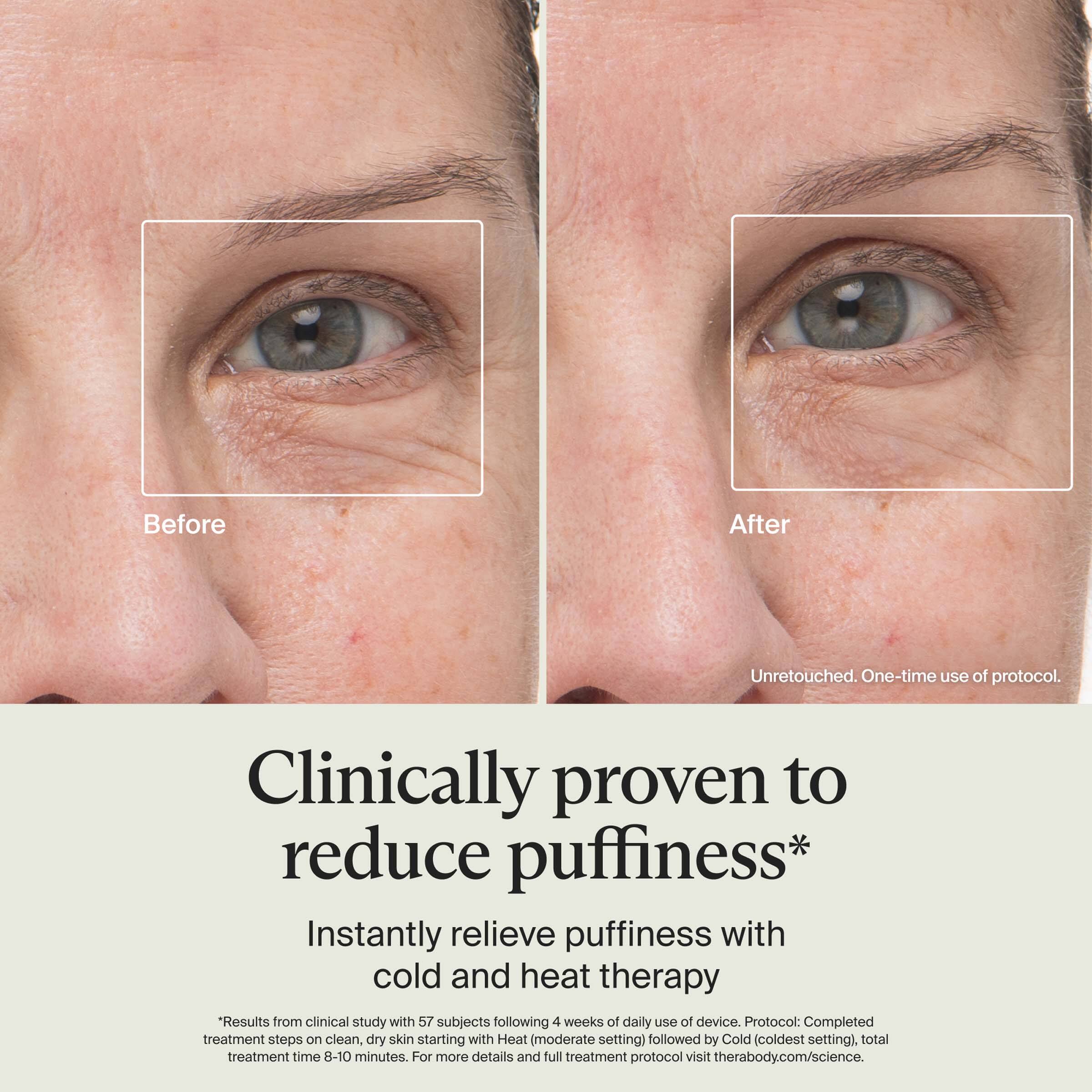 Before After Unretouched. One-time use of protocol.

Clinically proven to reduce puffiness*

Instantly relieve puffiness with cold and heat therapy

*Results from clinical study with 57 subjects following 4 weeks of daily use of device. Protocol: Completed treatment steps on clean, dry skin starting with Heat (moderate setting) followed by Cold (coldest setting), total treatment time 8-10 minutes. For more details and full treatment protocol visit therabody.com/science.