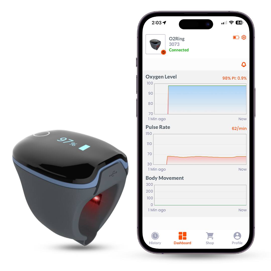 2:03  
84%  
O2Ring  
3073  
Connected  

Oxygen Level  
98% PI: 0.9%  

Pulse Rate  
62/min  

Body Movement  

History  
Dashboard  
Shop  
Profile