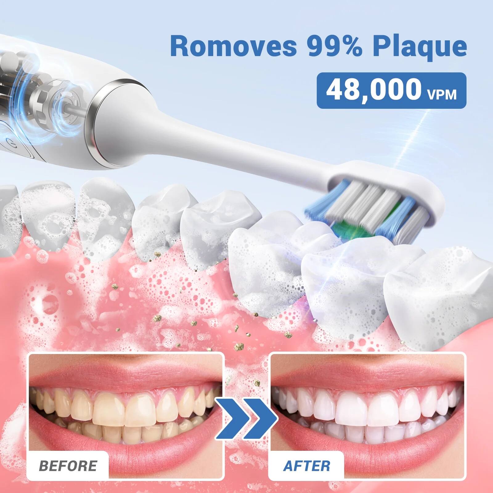 Removes 99% Plaque  
48,000 VPM  

BEFORE  
AFTER