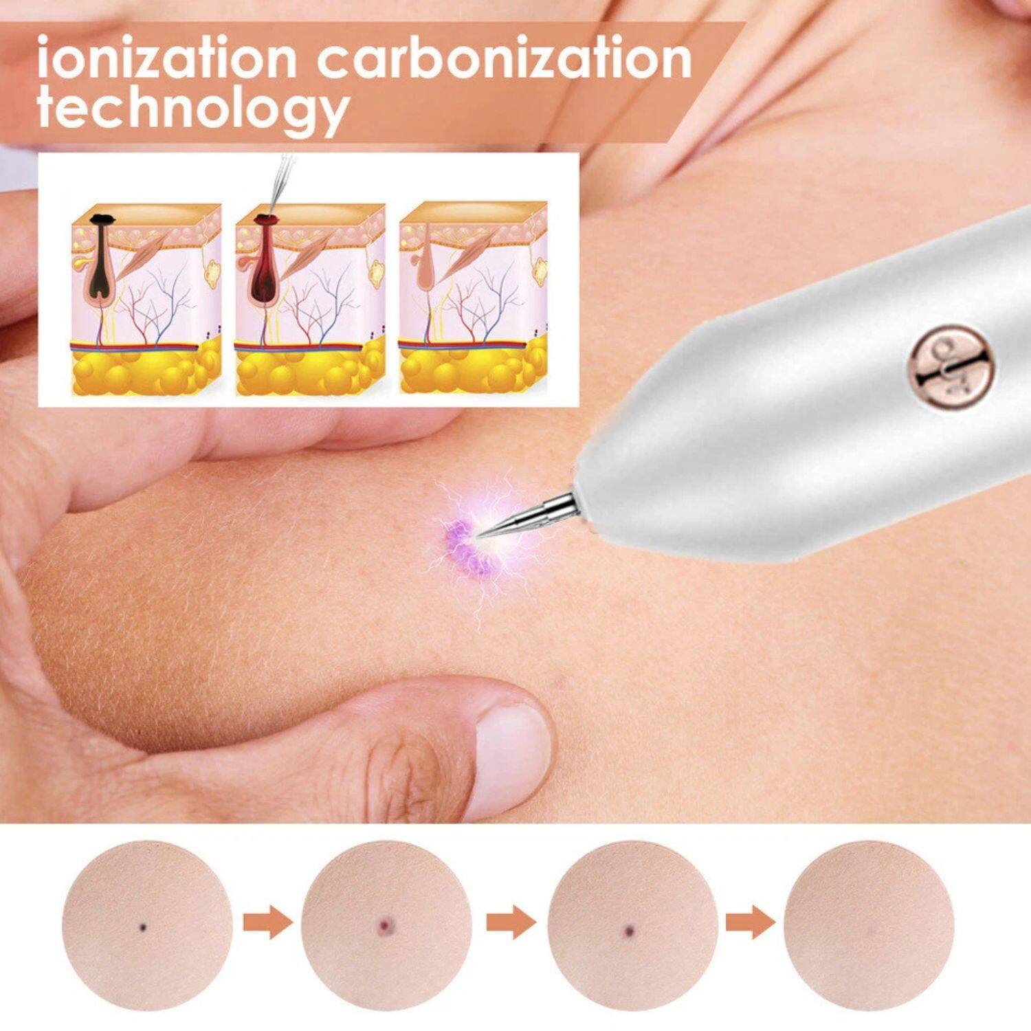 ionization carbonization technology

ionization carbonization technology