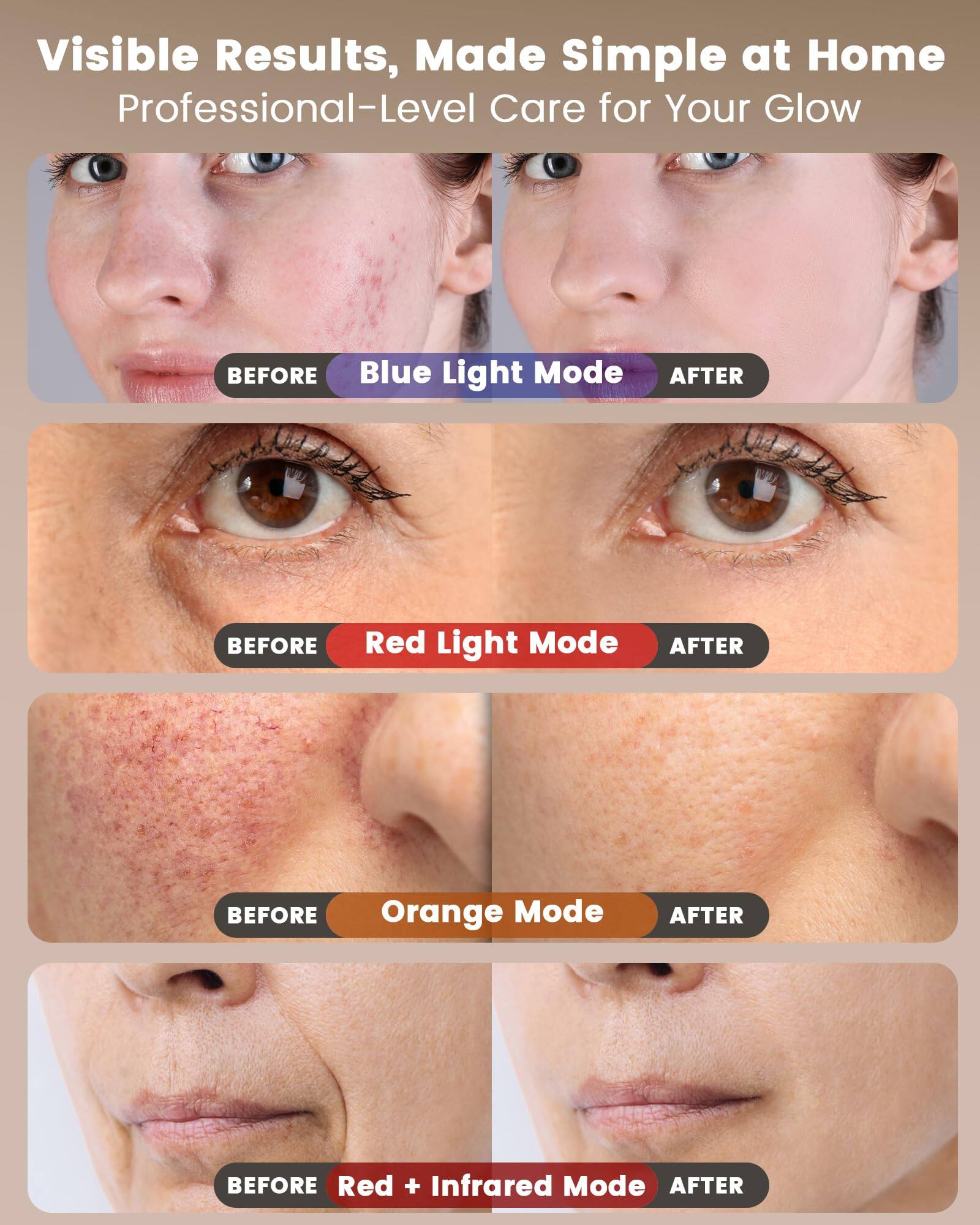Visible Results, Made Simple at Home  
Professional-Level Care for Your Glow  

- BEFORE Blue Light Mode AFTER  
- BEFORE Red Light Mode AFTER  
- BEFORE Orange Mode AFTER  
- BEFORE Red + Infrared Mode AFTER