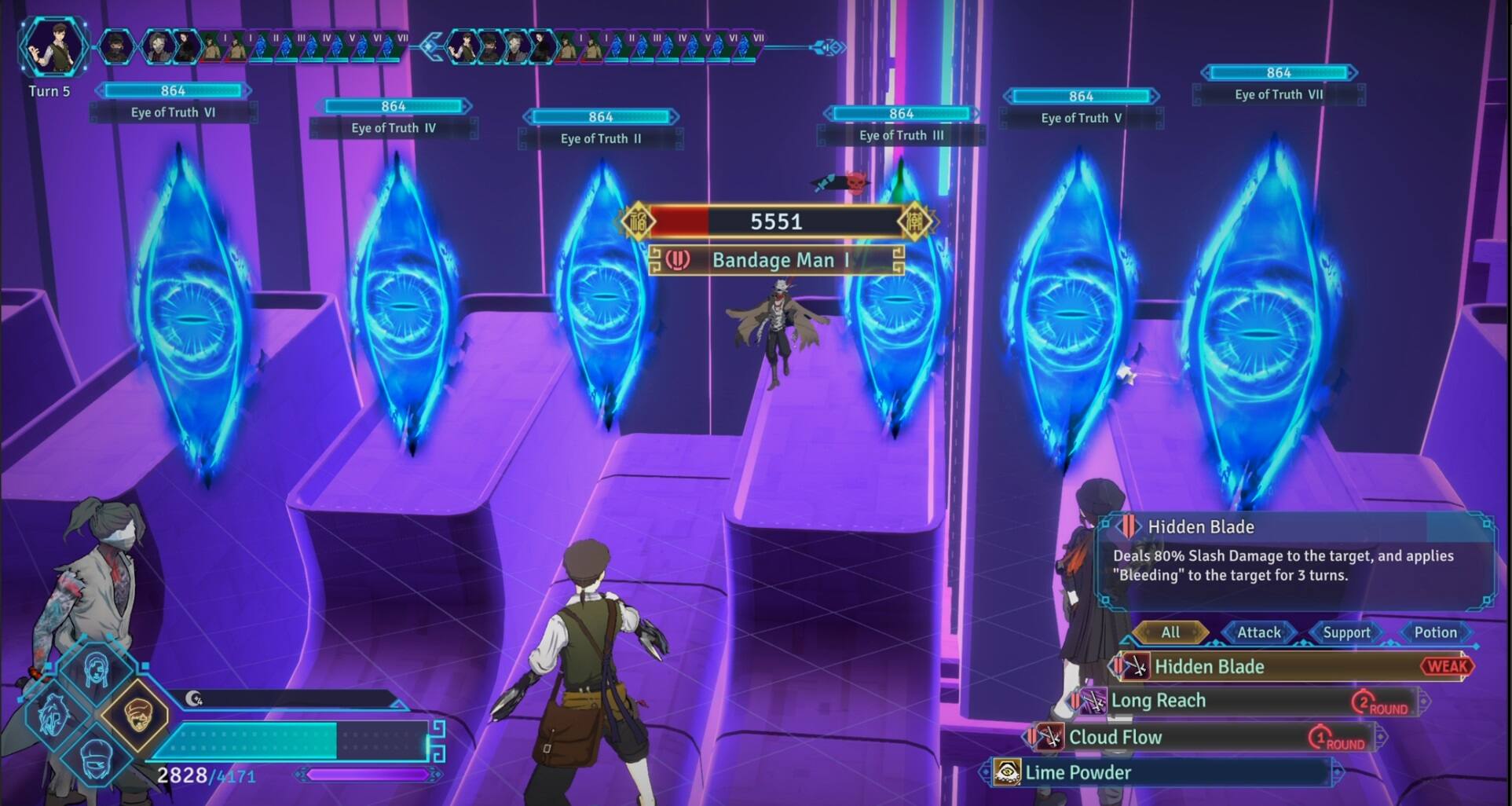 Alt View 14. PLAION - Mato Anomalies.