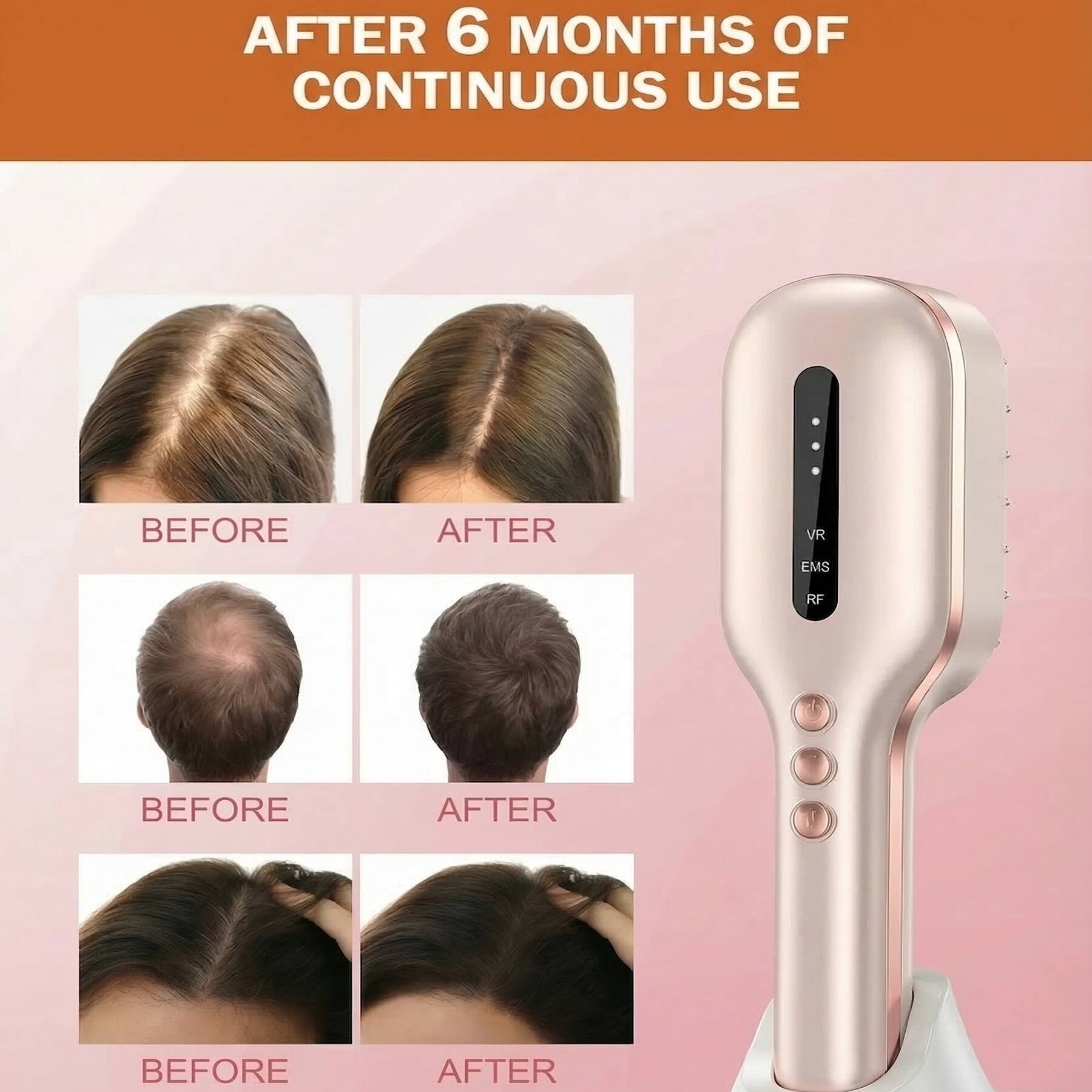 AFTER 6 MONTHS OF CONTINUOUS USE

BEFORE AFTER  
VR EMS RF

BEFORE AFTER  
VR EMS RF

BEFORE AFTER  
VR EMS RF