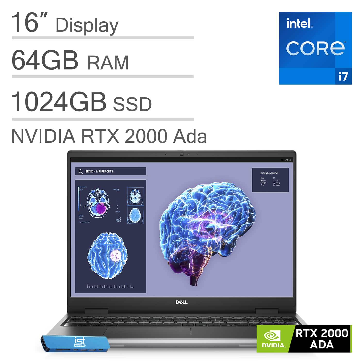 16" Display  
64GB RAM  
1024GB SSD  
NVIDIA RTX 2000 Ada  
Intel Core i7