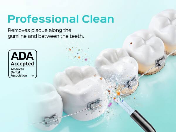 Professional Clean  
Removes plaque along the gumline and between the teeth.  
ADA Accepted  
American Dental Association