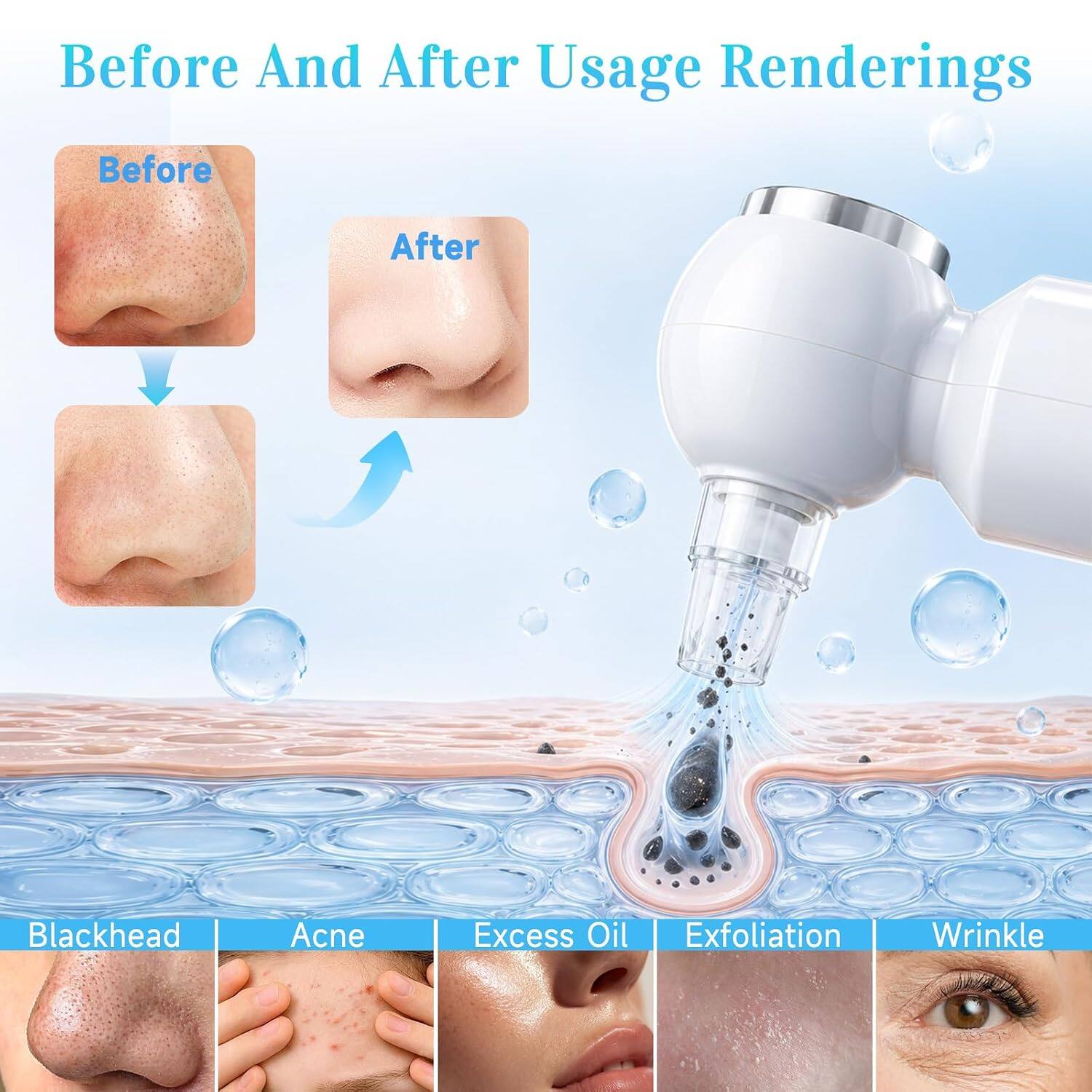 Before And After Usage Renderings

Before After

Blackhead Acne Excess Oil Exfoliation Wrinkle