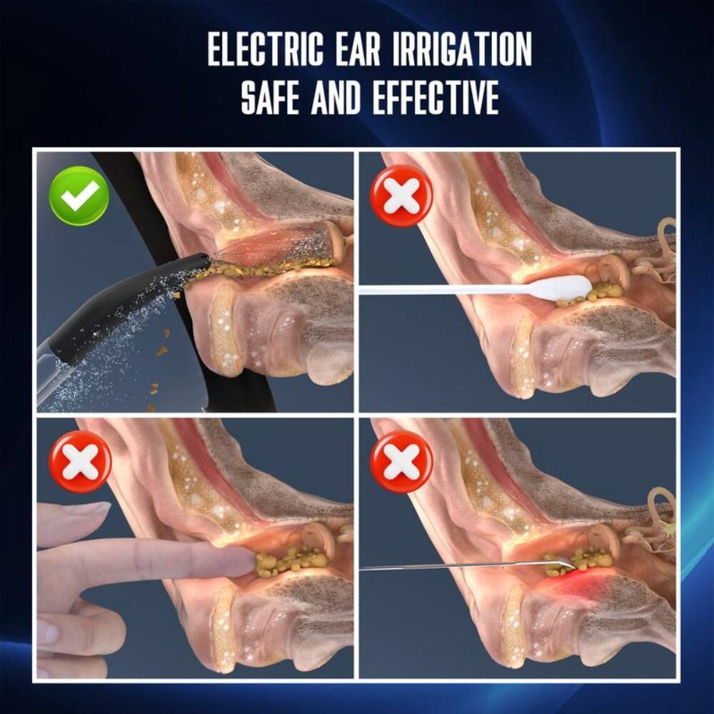 ELECTRIC EAR IRRIGATION  
SAFE AND EFFECTIVE