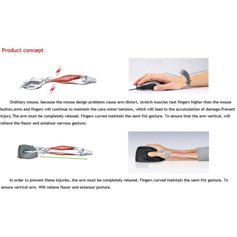 Product concept

Ordinary mouse, because the mouse design problems cause arm distort, stretch muscles taut fingers higher than the mouse button, arms and fingers will continue to maintain the care minor tensions, which will lead to the accumulation of damage. Prevent injury. The arm must be completely relaxed. Fingers curved maintain the semi-fist gesture. To ensure that the arm vertical, will relieve the flexor and extensor nervous gesture.

In order to prevent these injuries, the arm must be completely relaxed. Fingers curved maintain the semi-fist gesture. To ensure vertical arm. Will relieve flexor and extensor posture.